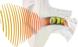 How Hearing Aids Work